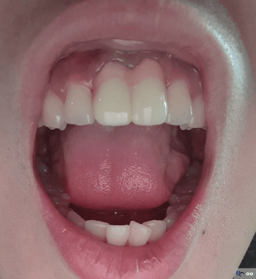 Ugh_HH/79413/6230930728619281884