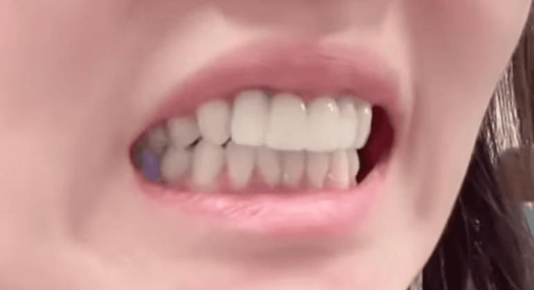 Ugh_HH/79454/6230809730800619268