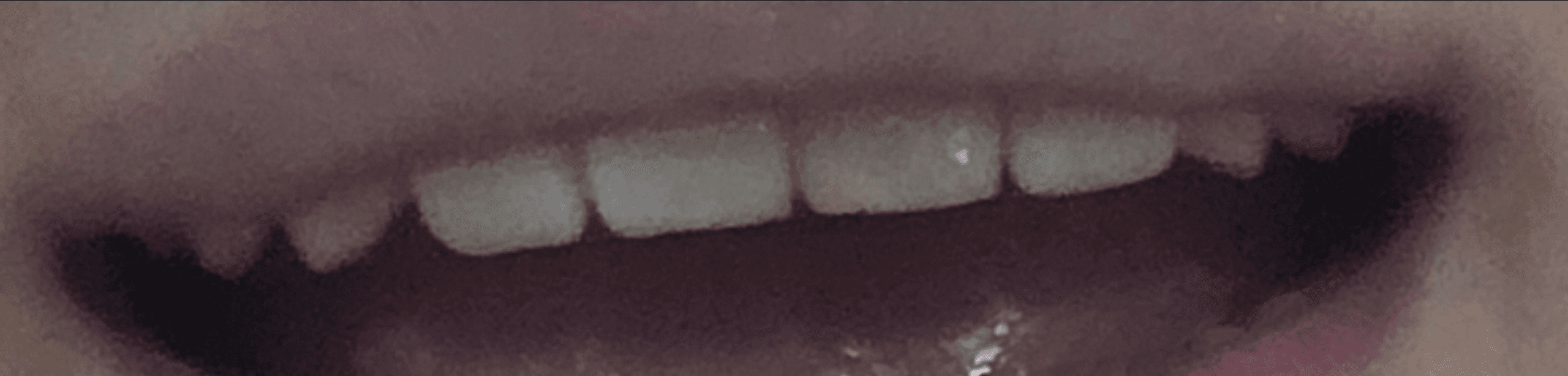 Ugh_HH/81603/6077674415618461605