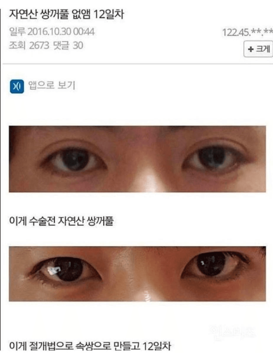 근데 ㄹㅇ 요즘 개나소나 다 쌍커풀 있어서 없는 게 더 예뻐보임